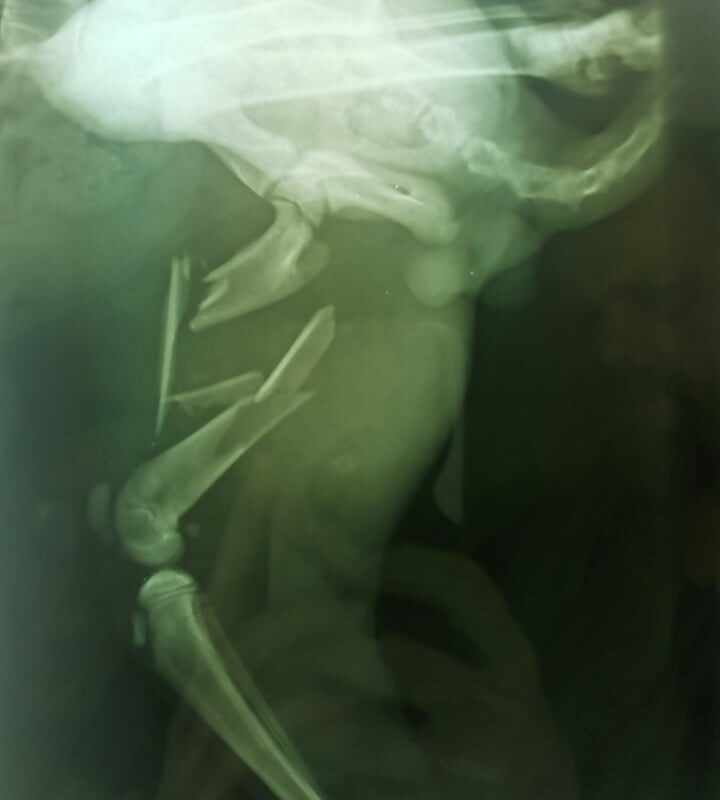 Pan Hrášek – rentgenový snímek zlomené nohy