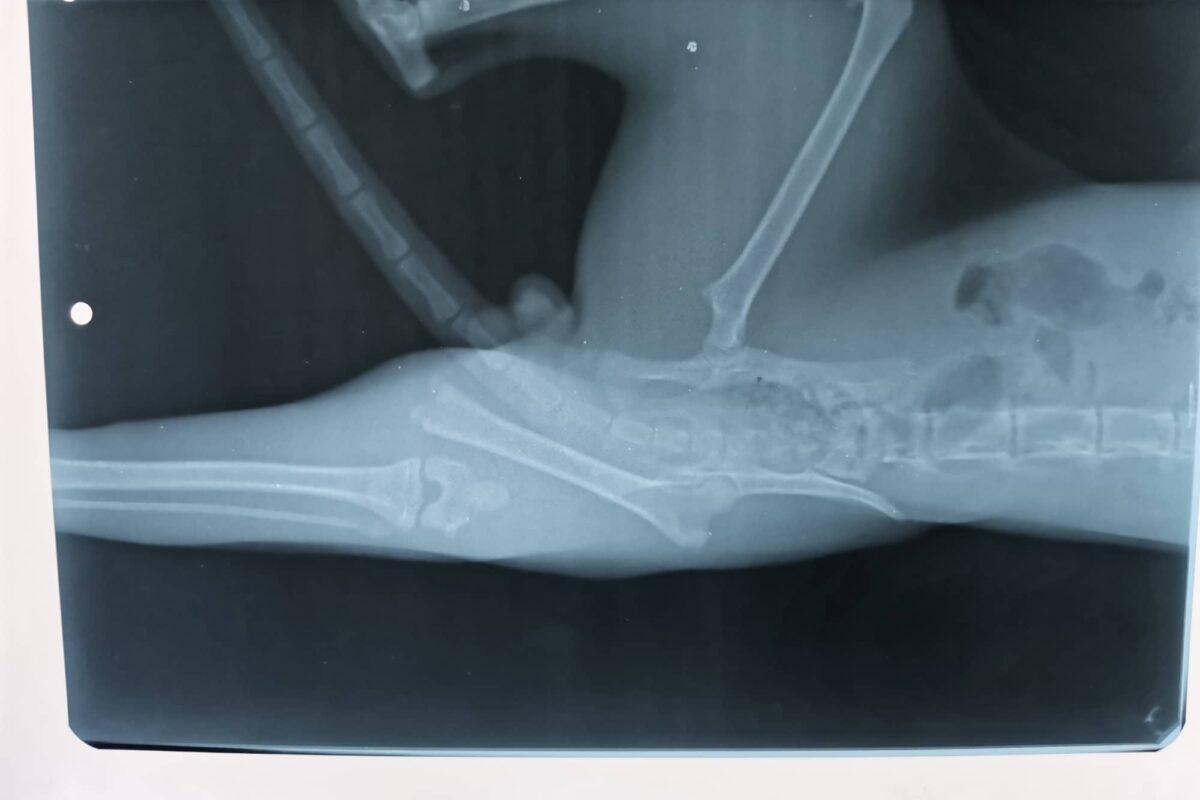 Rentgenový snímek zlomeniny nad kolenem