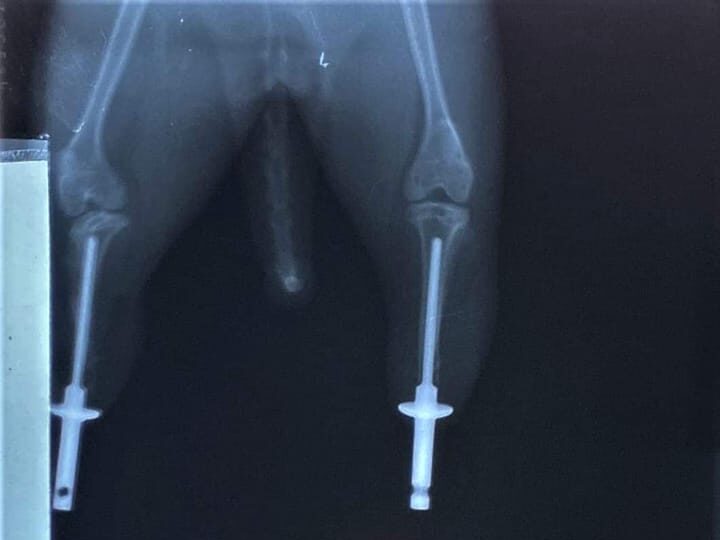 Rentgen Mojita s protézkami